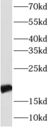      anti- Alpha B Crystallin antibody