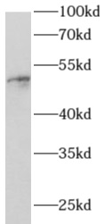      anti- Angiopoietin 1 antibody