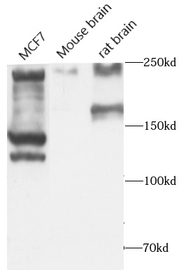      anti- ALK,CD246 antibody