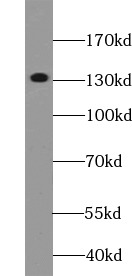      anti- AFF1 antibody