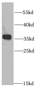      anti- AMPK beta 2 antibody