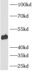      anti- ATP6AP1 antibody