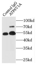      anti- ATP6V1A antibody