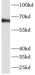      anti- ATP6V1A antibody