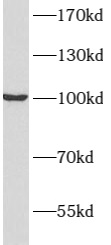      anti- ATP1A2 antibody