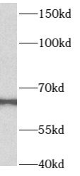      anti- B4GALNT2 antibody