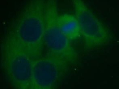      anti- ASB13 antibody