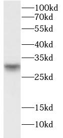      anti- ASB13 antibody