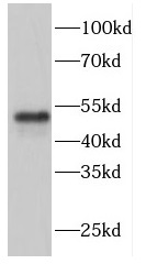      anti- FBXW4 antibody