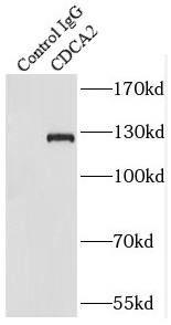      anti- CDCA2 antibody