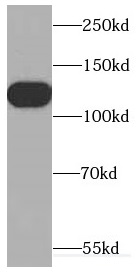      anti- CDCA2 antibody