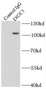      anti- EXOC1 antibody