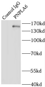 PNPLA6抗体