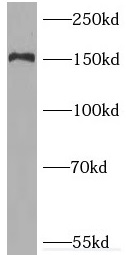      anti- PNPLA6 antibody