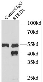 STBD1抗体