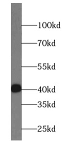      anti- STBD1 antibody