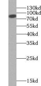      anti- XPR1 antibody