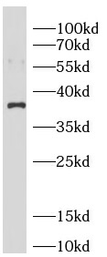      anti- Annexin A1 antibody