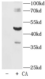 Phospho-Tau-T181 抗体