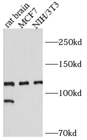      anti- HDAC7 antibody