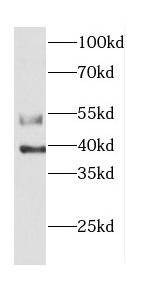      anti- Caspase 12 antibody