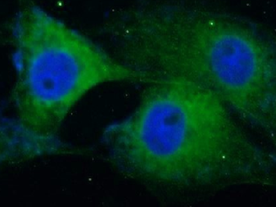      anti- alpha-synuclein antibody