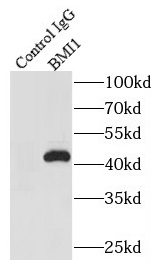      anti- BMI1 antibody