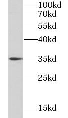      anti- BCL2L1 antibody