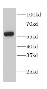      anti- calreticulin antibody